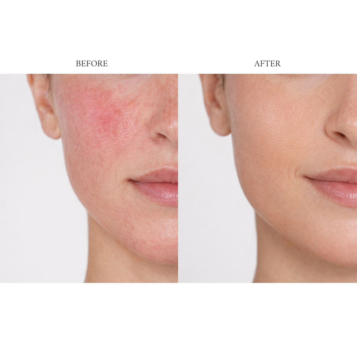 The Chamomist Hydra-Calm Soothing Gel | AROSEÈ – Aroseè Cosmetics