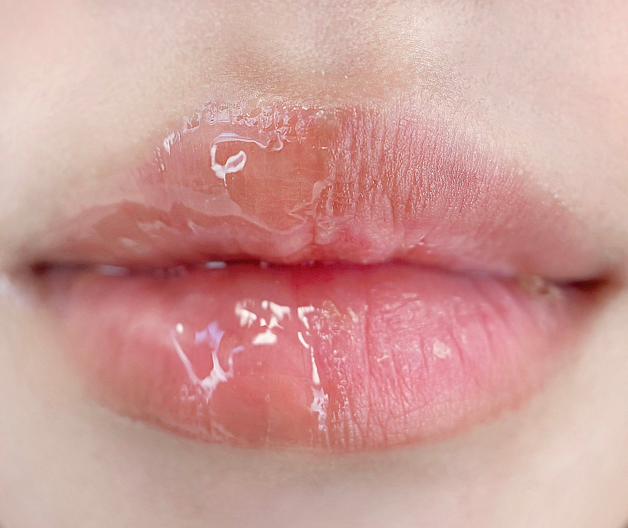 Aroseè Rose Lip Gel : Why Do Lips Get Dry Even When You’re Drinking Plenty of Water?